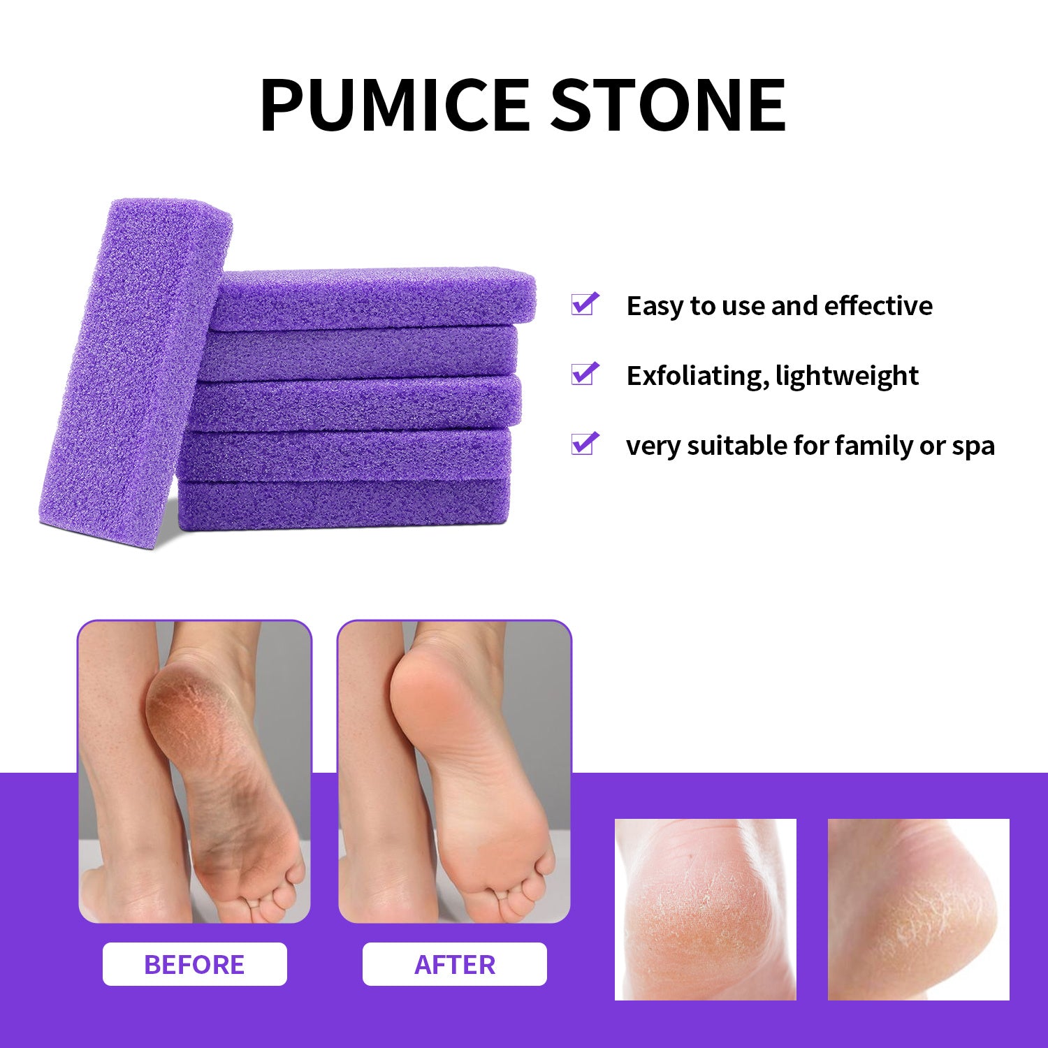 Nailpink, 40pcs Professional pumice pads for removing cracked heels, Bulk Pack For Spa And Personal Use. ( Multi-pack: 40-pack )
