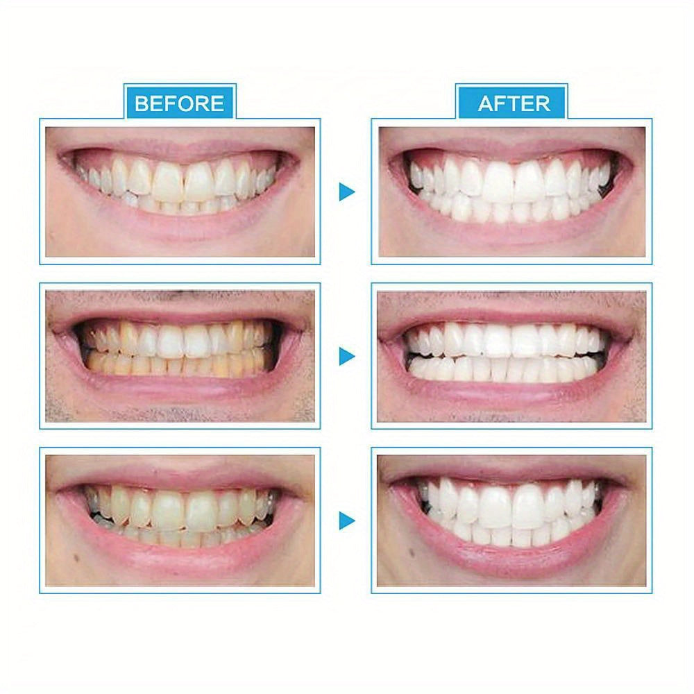 Fast-Acting Portable Teeth Whitening LED Light - Blue, Battery-Powered, Easy-to-Use for Home & Travel