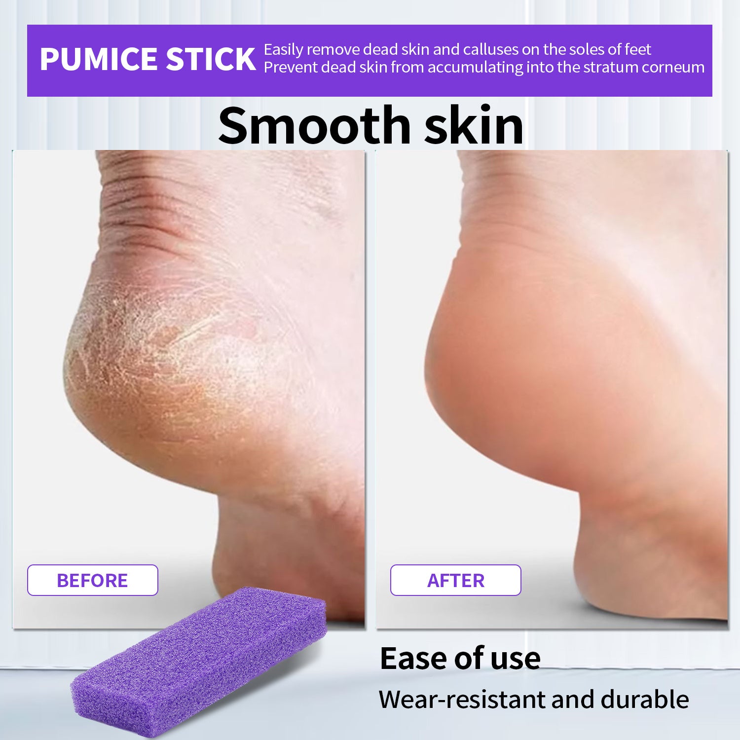 Nailpink, 40pcs Professional pumice pads for removing cracked heels, Bulk Pack For Spa And Personal Use. ( Multi-pack: 40-pack )